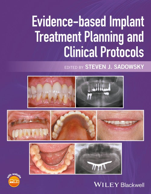 Evidence-based Implant Treatment Planning and Clinical Protocols by Steven J Sadowsky ISBN 9781119080039