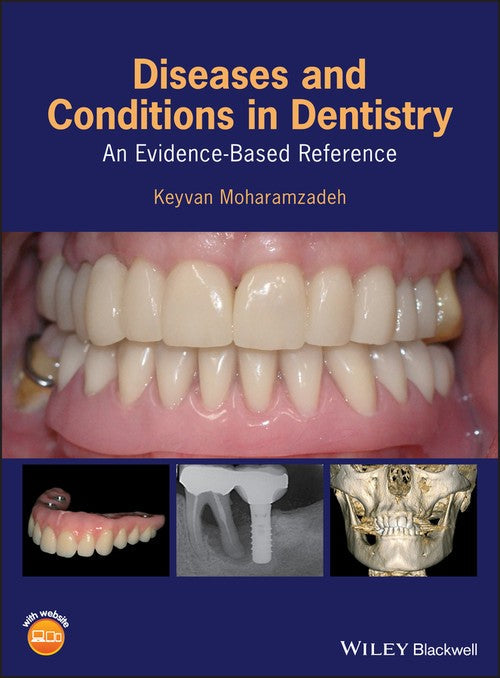 Diseases and Conditions in Dentistry by Keyvan Moharamzadeh ISBN 9781119312031