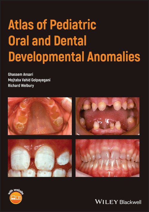 Atlas of Pediatric Oral and Dental Developmental Anomalies by Ghassem Ansari ISBN 9781119380856
