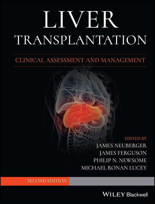 Liver Transplantation by James Neuberger ISBN 9781119633983