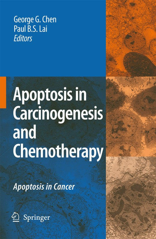 Apoptosis in Carcinogenesis and Chemotherapy by George G Chen ISBN 9781402095962