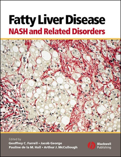 Fatty Liver Disease by Geoffrey C Farrell ISBN 9781405112925