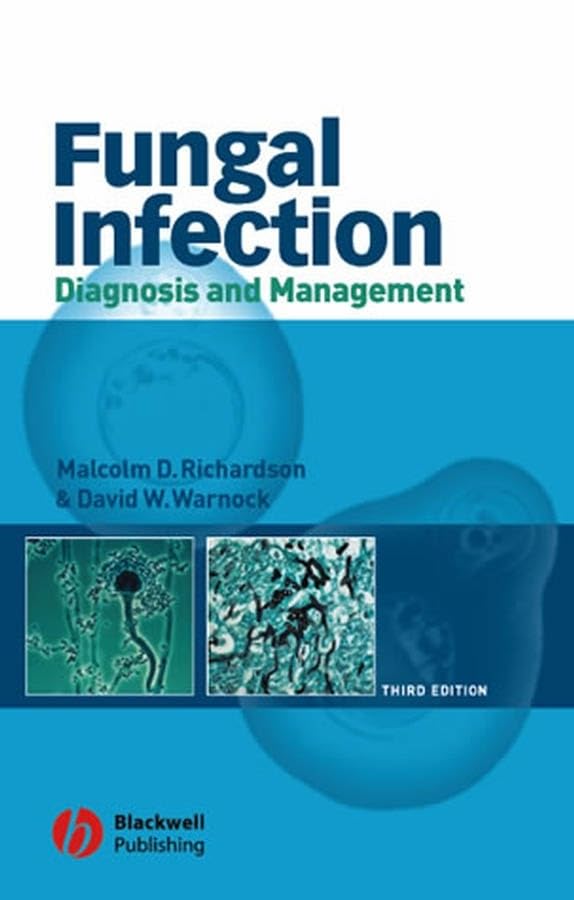 Fungal Infection by Malcolm D Richardson ISBN 9781405115780