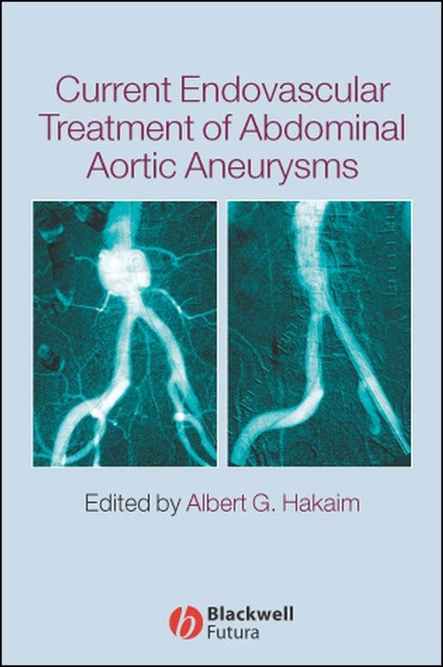 Current Endovascular Treatment of Abdominal Aortic Aneurysms by Albert G Hakaim ISBN 9781405122054