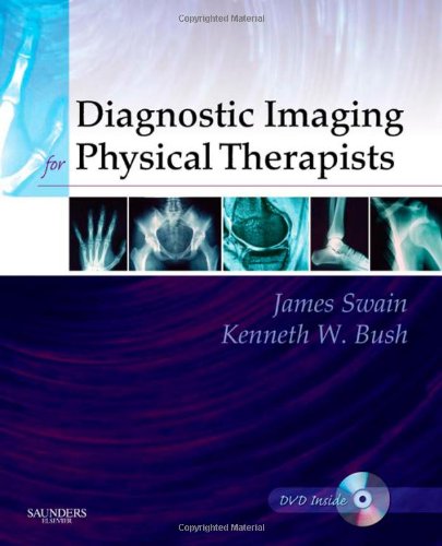 Diagnostic Imaging for Physical Therapists by James Swain Mpt ISBN 9781416029038