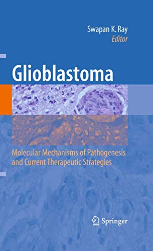 Glioblastoma: by Swapan K Ray ISBN 9781441904096