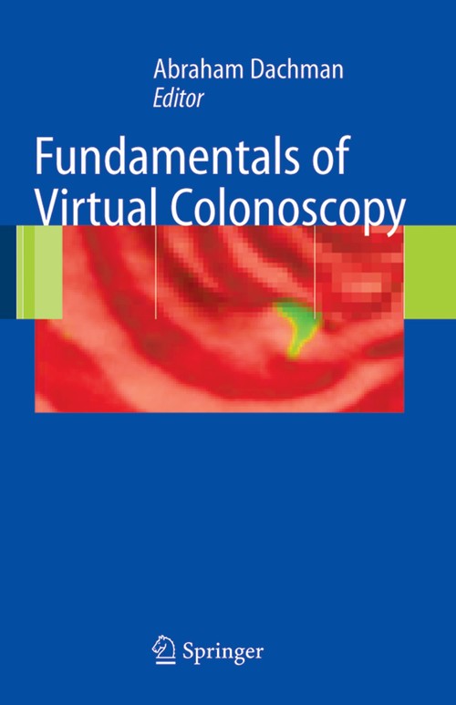 Fundamentals of Virtual Colonoscopy by Abraham H Dachman ISBN 9781441919526