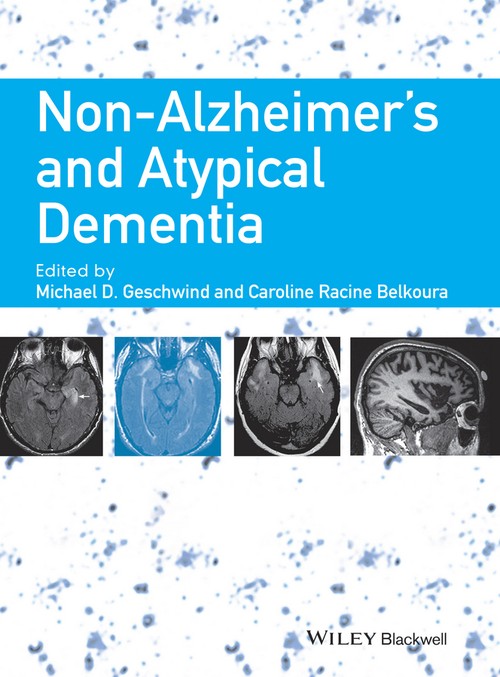Non-Alzheimer's and Atypical Dementia by Michael D Geschwind ) ISBN 9781444336245