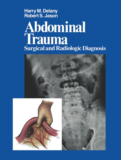 Abdominal Trauma by H M Delany ISBN 9781461258520