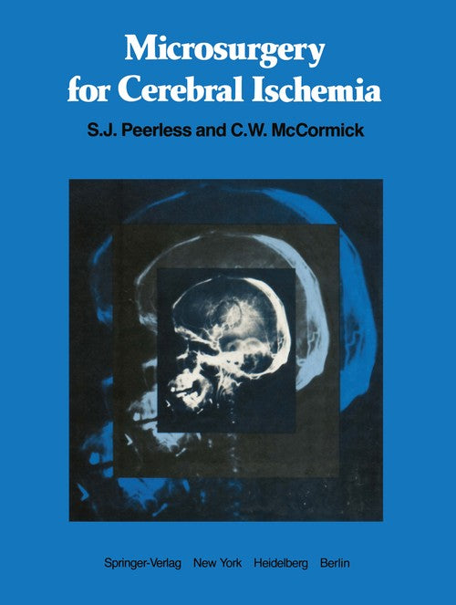 Microsurgery for Cerebral Ischemia by Sj Peerless ISBN 9781461260929