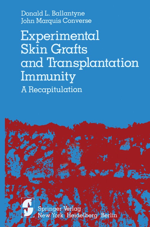 Experimental Skin Grafts and Transplantation Immunity by D L Ballantyne ISBN 9781461262251
