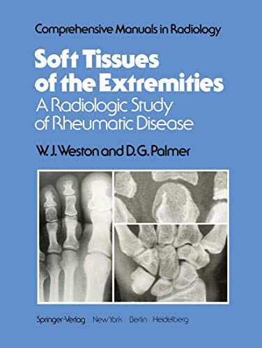 Soft Tissues of the Extremities by W J Weston ISBN 9781461262534