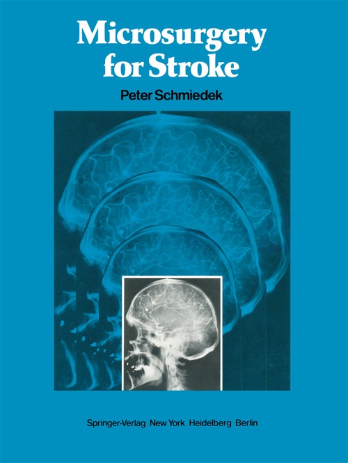 Microsurgery for Stroke by P Schmiedek ISBN 9781461263517
