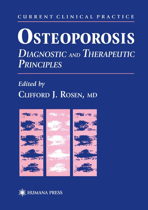Osteoporosis by Clifford J Rosen ISBN 9781461266686