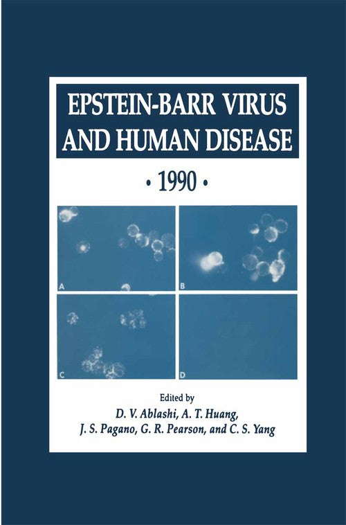 Epstein-Barr Virus and Human Disease · 1990 by D V Ablashi 9781461267478