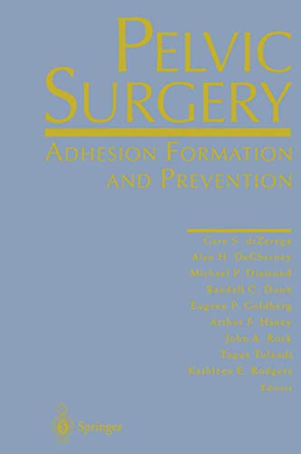 Pelvic Surgery by Gere S Dizerega ISBN 9781461273165