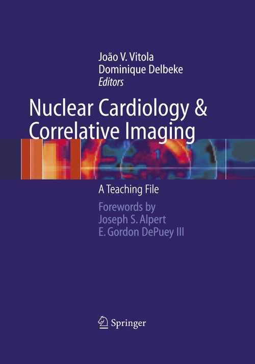 Nuclear Cardiology and Correlative Imaging by Joao V Vitola ISBN 9781461273929