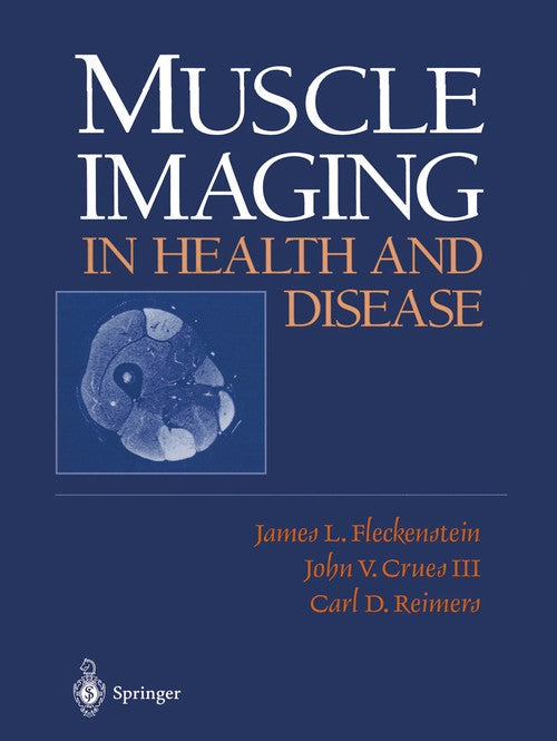Muscle Imaging in Health and Disease by James L Fleckenstein ISBN 9781461274988