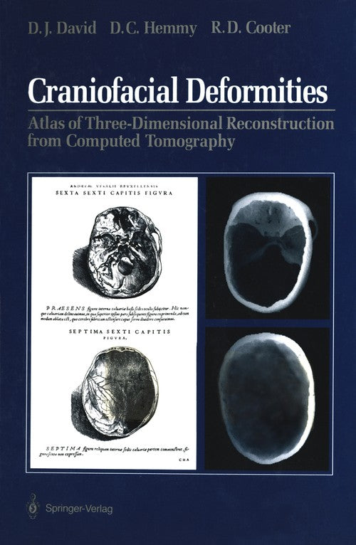Craniofacial Deformities by David J David ISBN 9781461279266