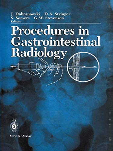 Procedures in Gastrointestinal Radiology by Lynne Mclean ISBN 9781461279617