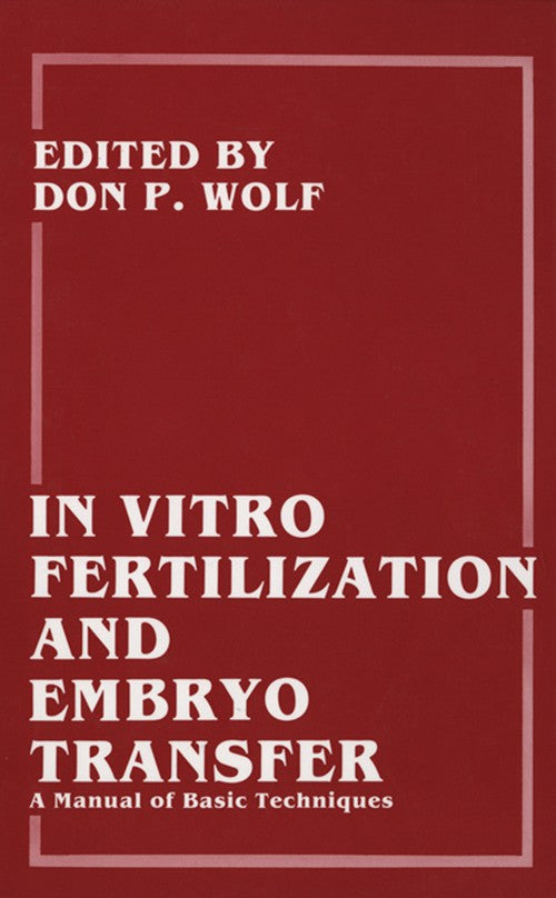 In Vitro Fertilization and Embryo Transfer by Barry D Bavister ISBN 9781461282884