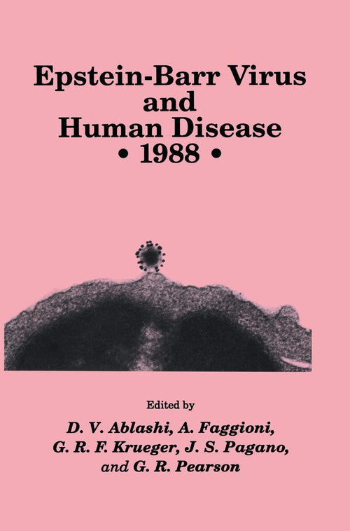 Epstein-Barr Virus and Human Disease • 1988 by D V Ablashi 9781461288527