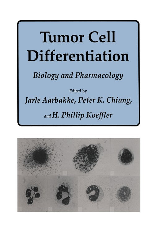 Tumor Cell Differentiation by Jarle Aarbakke ISBN 9781461289418