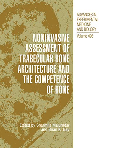 Noninvasive Assessment of Trabecular Bone Architecture and The Competence of Bone by Sharmila Majumdar ISBN 9781461351771