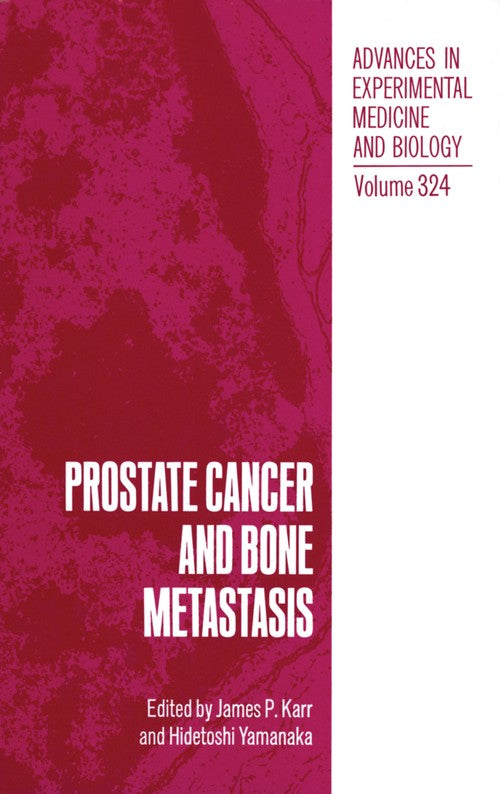 Prostate Cancer and Bone Metastasis by James P Karr ISBN 9781461365013
