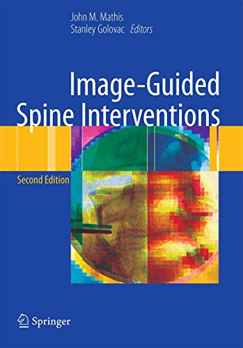 Image-Guided Spine Interventions by John Mathis ISBN 9781461405252
