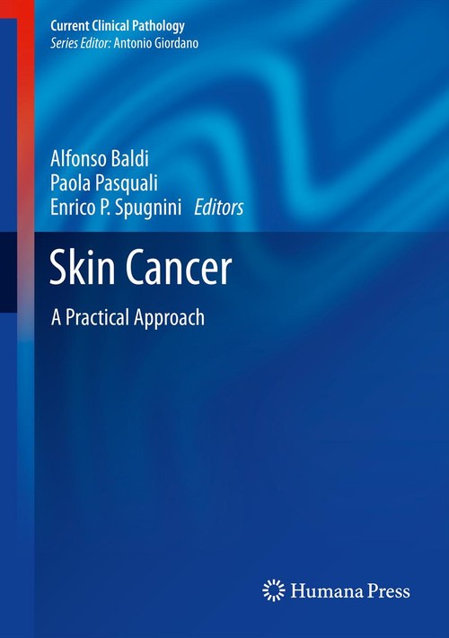Skin Cancer by Alfonso Baldi 9781461473565