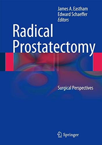 Radical Prostatectomy by James A Eastham ISBN 9781461486923
