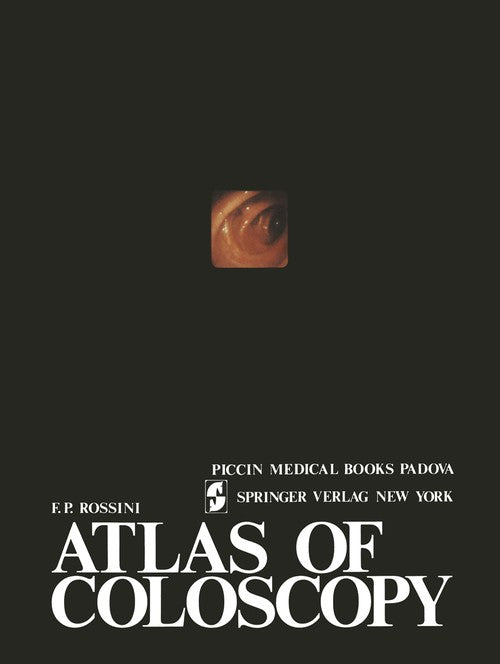 Atlas of coloscopy by Rossini ISBN 9781461596523