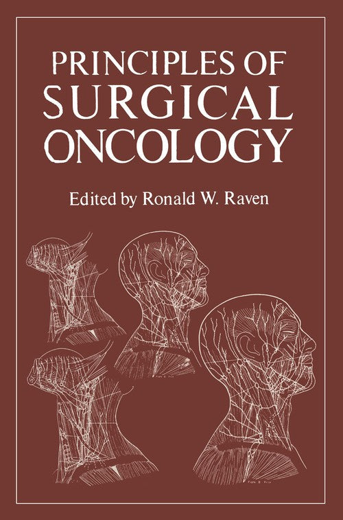Principles of Surgical Oncology by Ronald Raven ISBN 9781468423037