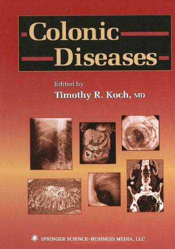 Colonic Diseases by Timothy R Koch ISBN 9781468497403