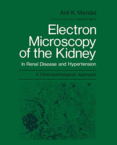 Electron Microscopy of the Kidney ISBN 9781475717013