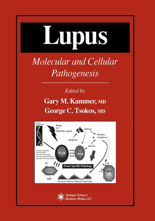 Lupus by Gary M Kammer ISBN 9781475756869