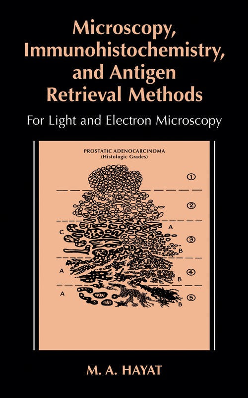 Microscopy, Immunohistochemistry, and Antigen Retrieval Methods by Ma Hayat ISBN 9781475776331