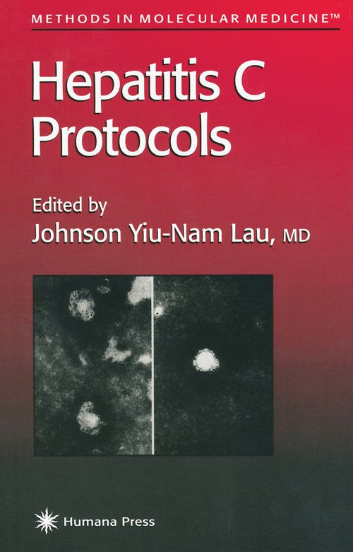 Hepatitis C Protocols by Johnson Y N Lau ISBN 9781489943484