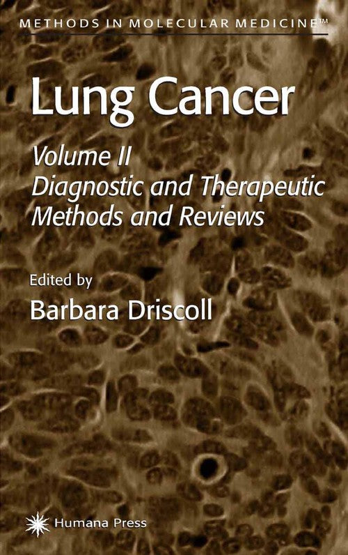 Lung Cancer by Barbara Driscoll ISBN 9781489944191