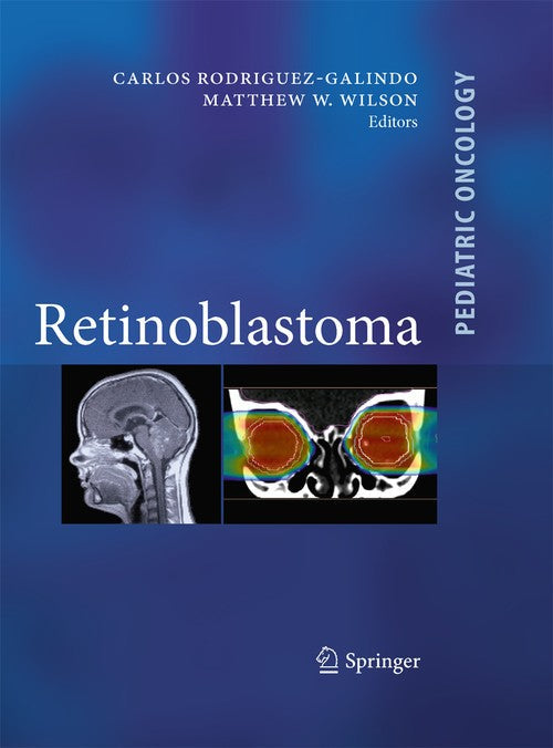 Retinoblastoma by Carlos Rodriguez Galindo ISBN 9781489977533