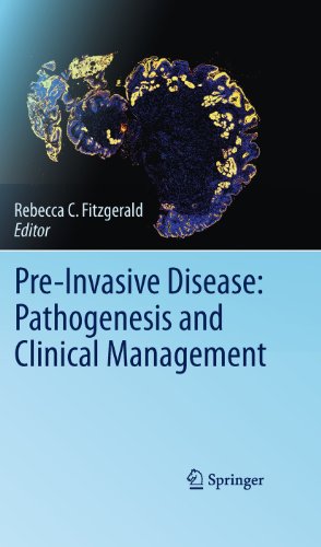 Pre-Invasive Disease: Pathogenesis and Clinical Management by Rebecca C Fitzgerald ISBN 9781489982254