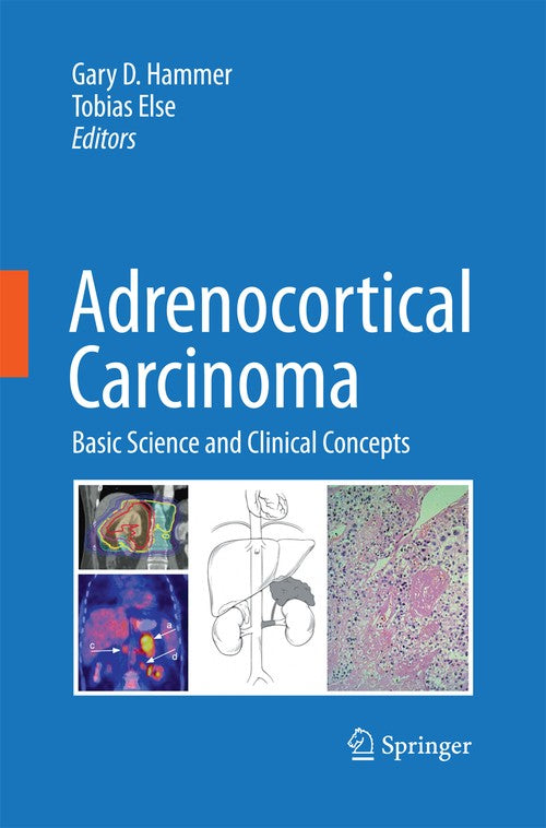 Adrenocortical Carcinoma by Gary D Hammer ISBN 9781489982629