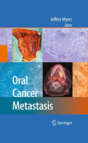 Oral Cancer Metastasis by Jeffrey Myers ISBN 9781489984760