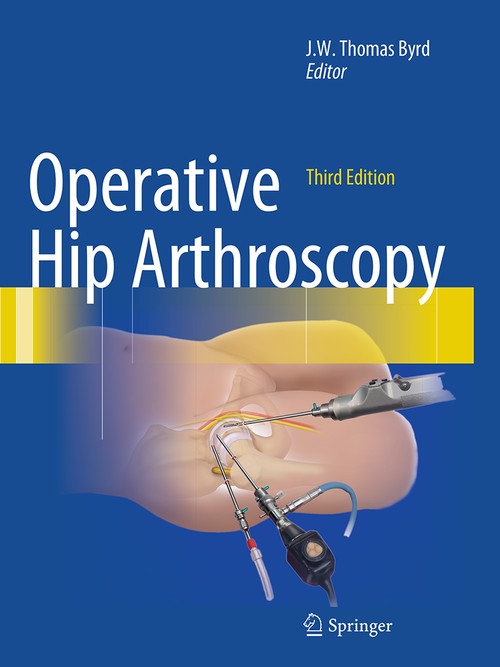 Operative Hip Arthroscopy by Jw Thomas Byrd ISBN 9781489986412