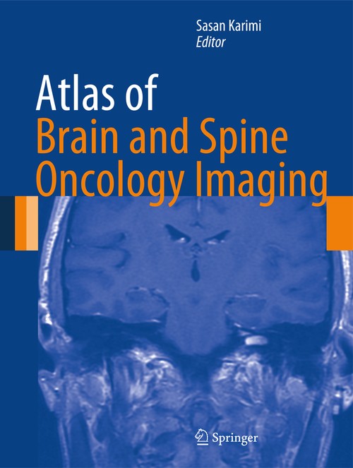 Atlas of Brain and Spine Oncology Imaging by Sasan Karimi ISBN 9781489992215
