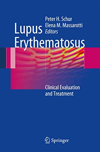 Lupus Erythematosus by Peter H Schur ISBN 9781489994615