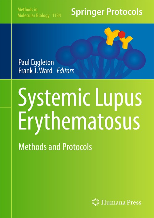 Systemic Lupus Erythematosus by Paul Eggleton 9781493903252