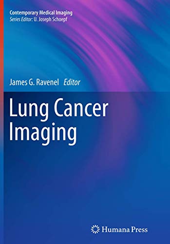 Lung Cancer Imaging by James G Ravenel 9781493940684