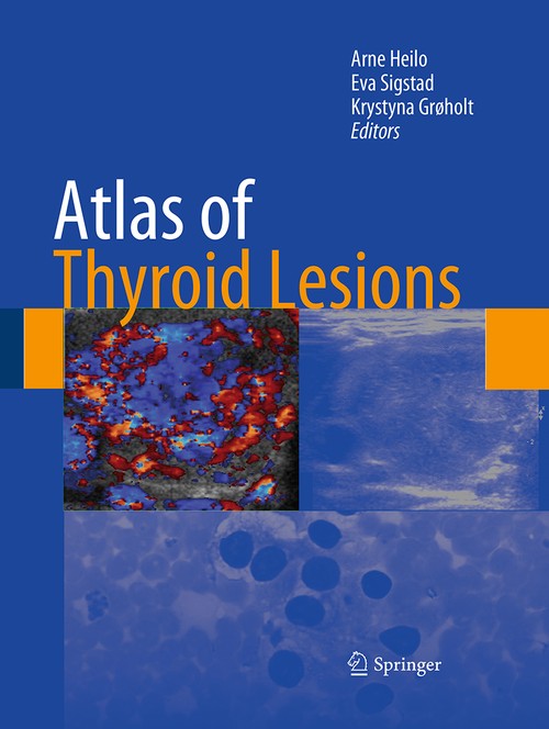 Atlas of Thyroid Lesions by Arne Heilo ISBN 9781493940813